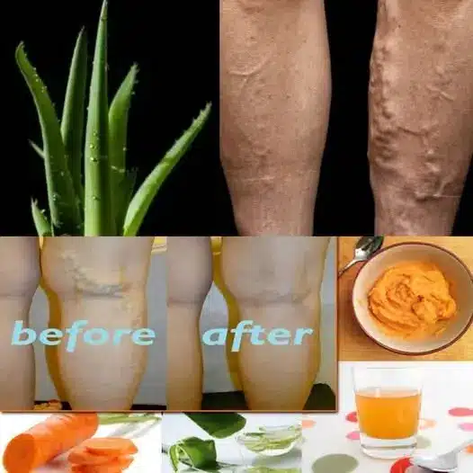 A person applying clear aloe vera gel to their legs in a gentle upward motion.