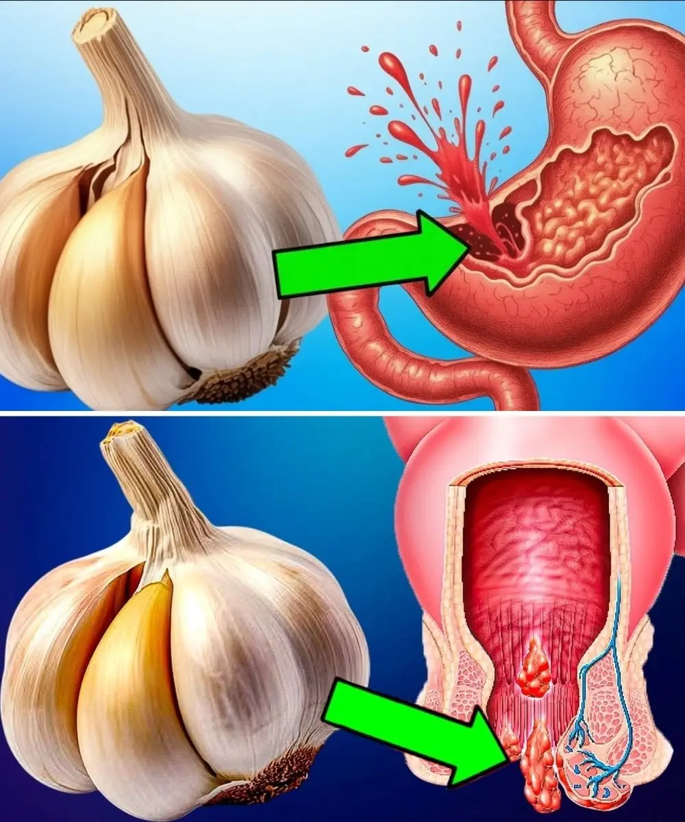 Minced garlic in a small glass bowl next to whole garlic cloves