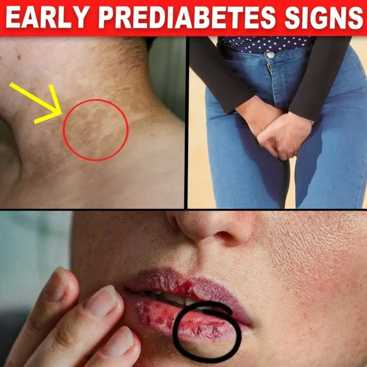 A person taking a brisk walk outdoors to improve insulin sensitivity and overall health.