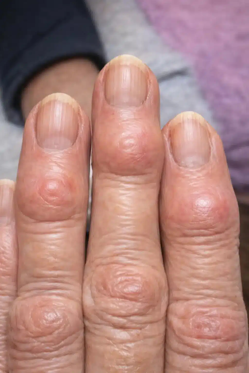 Person performing gentle hand stretches to improve finger joint mobility