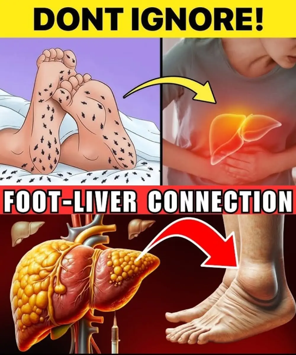 A person elevating their feet to reduce swelling, symbolizing proactive liver health management.