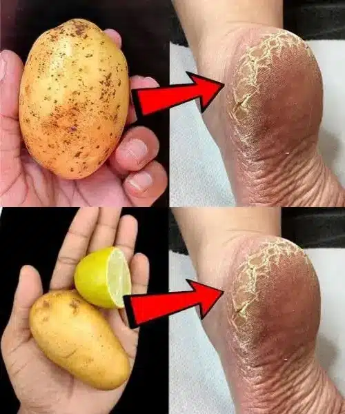 A person applying a natural foot mask for smooth heels